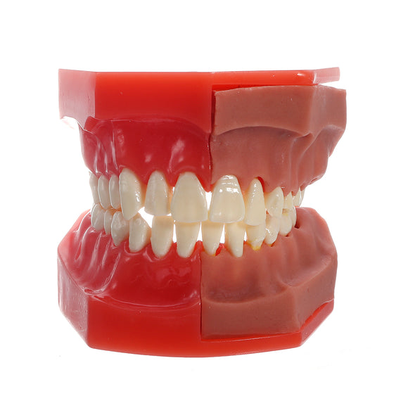 Dental Tools Medical Model Of The Dental Model Deciduous Tooth Replacement Model
