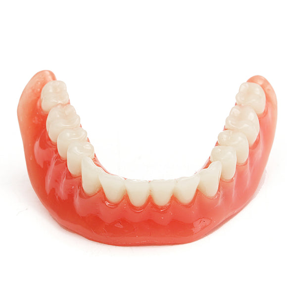 Precision Implants Restoration Teeth Demo Model Dental Overdenture Emulational
