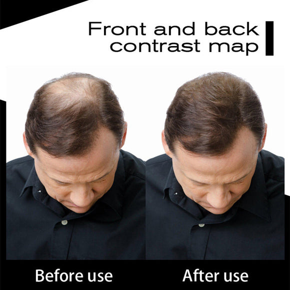 25g Hair Growth Fiber Hair Loss Concealer Thick Hair Fiber Hair Building Fibers Powder Hair Care