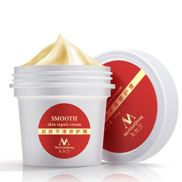 Women Smooth Skin Cream Scar Removal Skin Body Stretch Mark Repair Cream Beauty Care