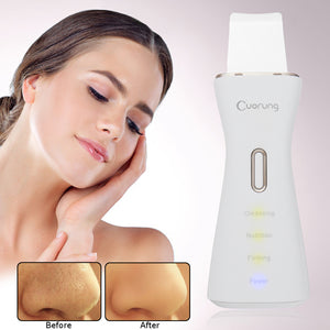 Facial Ultrasonic Ultrasound Skin Care Scrubber Blackhead Acne Remover Cleaner