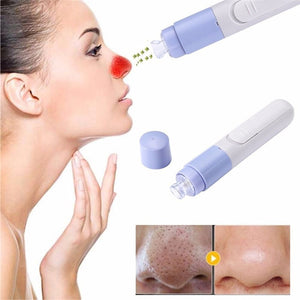 Electric Blackhead Suction Remover Facial Skin Pore Cleanser Anion Anti Acne Machine